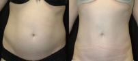 ab3_front