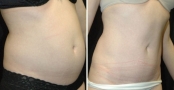 ab3_oblique