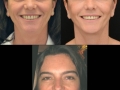 cfr10-25-15smiling