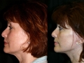 face12